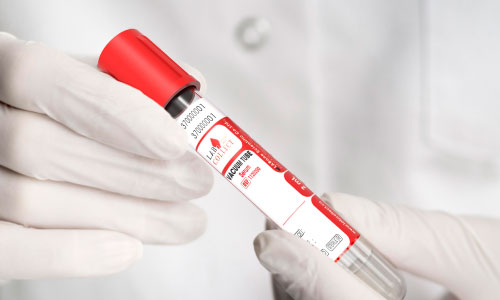 Ống lấy máu không chân không