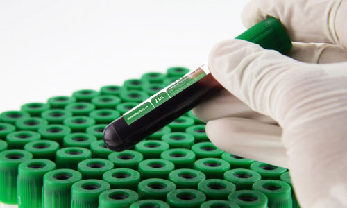 Ống lấy máu nhi