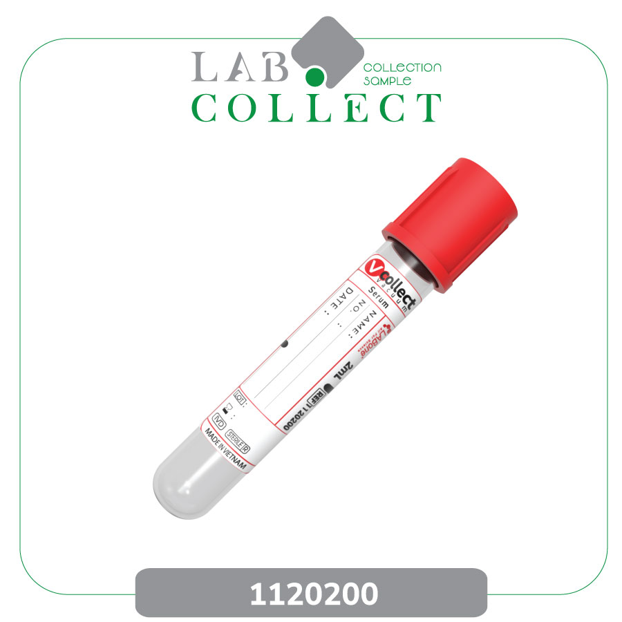 Ống lấy máu chân không Serum 2mL