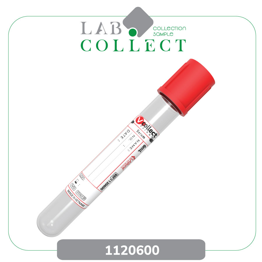 Ống lấy máu chân không Serum 6mL