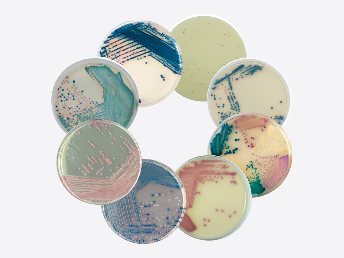 Môi trường sinh màu đĩa 90